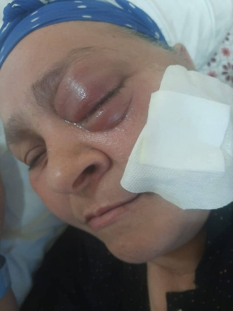 إهمال طبي في مستشفى 6 أكتوبر يُطفئ عيون المرضى