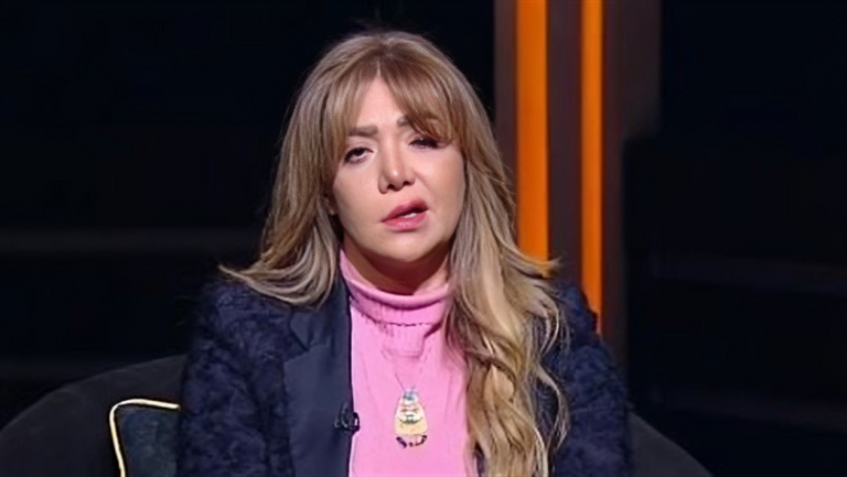 173-234133-liqaa-sweidan-bell-palsy-diagnosis-2 173-234133-liqaa-sweidan-bell-palsy-diagnosis-2